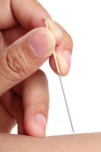 Conditions treated with acupuncture