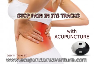 Acupuncture for Chronic Pain in Aventura Florida
