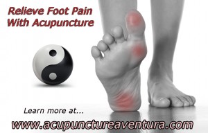 Acupuncture for Foot Pain in Aventura Florida 33160