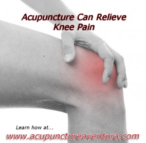 Acupuncture for Knee Pain in Aventura Florida 33160
