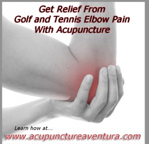 Acupuncture for Tennis and Golf Elbow in Aventura Florida 33160