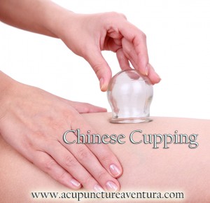 Chinese Cupping in Aventura Florida 33160