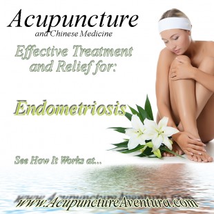 Acupuncture Effectively Treats Endometriosis