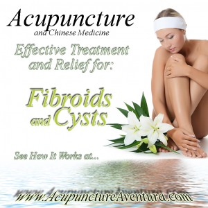 Acupuncture for Uterine Fibroids in Aventura Florida