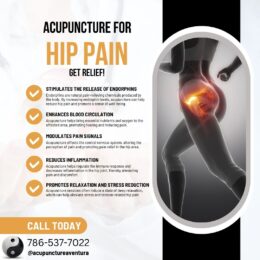 Acupuncture for Hip Pain in Aventura Florida